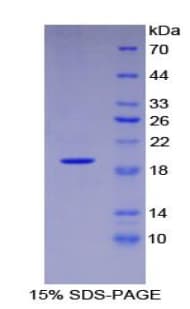 Human VEGFA / VEGF Protein (Recombinant His)