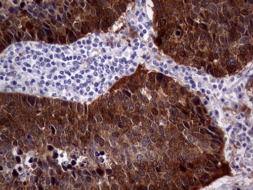 p16INK4a / CDKN2A Antibody (clone OTI4H4, Carrier-free)