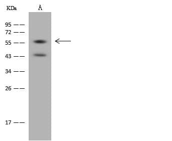Polyclonal Rabbit anti-Human WAS / WASP Antibody (WB)