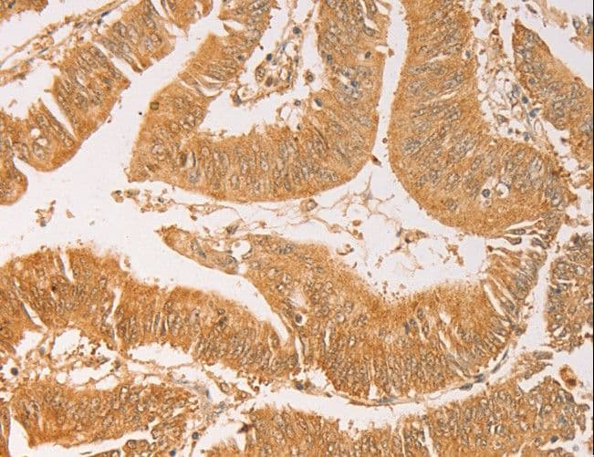 AK2 / Adenylate Kinase 2 Antibody