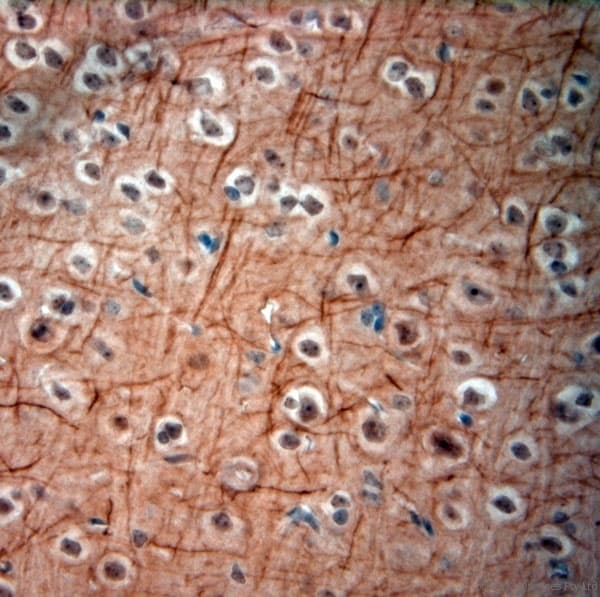 NEFH / NF-H Antibody (aa150-200)