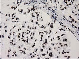 CTDSP1 / SCP1 Antibody (clone OTI1G1)