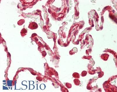 IHC-plus™ NFIB Antibody (aa225-275)