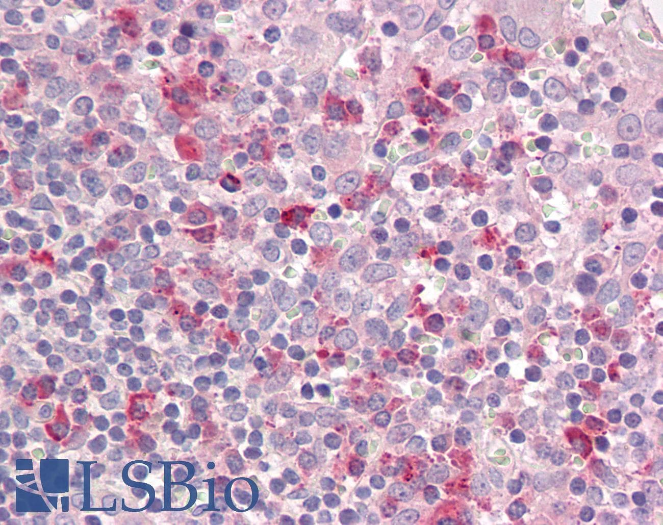 IHC-plus™ LAIR1 / CD305 Antibody (aa69-81)
