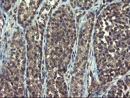 RPN1 / Ribophorin I Antibody (clone OTI5B1, Carrier-free)