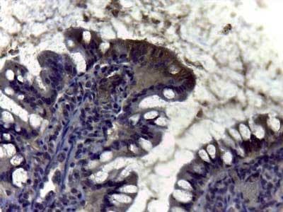 CA2 / Carbonic Anhydrase II Antibody (Lyophilized)