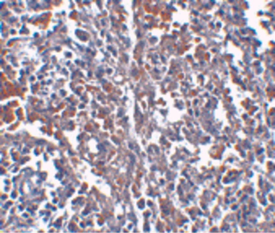 Monoclonal Mouse anti-Human TMEM142A / ORAI1 Antibody (clone 3F6H5, IHC, IF, WB)