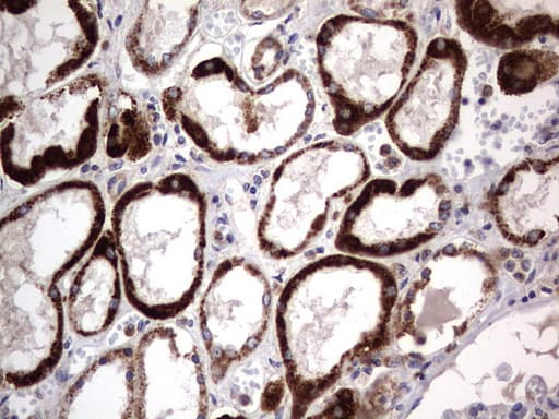 PRX-1 / PRRX1 Antibody (clone OTI1E10)