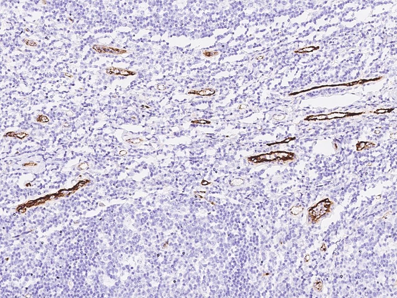 VWF / Von Willebrand Factor Antibody