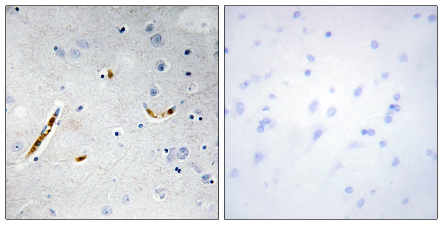 TCF3 / E2A Antibody (aa571-620)