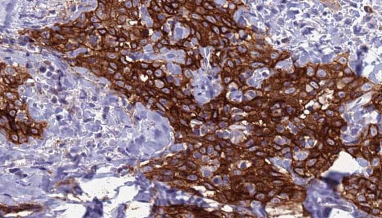 Polyclonal Rabbit anti-Human CD302 Antibody (IHC, IF, WB)