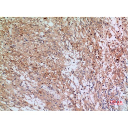 Polyclonal Rabbit anti-Human INHBB / Inhibin Beta B Antibody (351-400 aa, C-terminal, IHC, WB)
