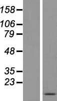 FDC-SP / C4orf7 Protein (Over-Expression Lysate Myc-DDK (Flag))