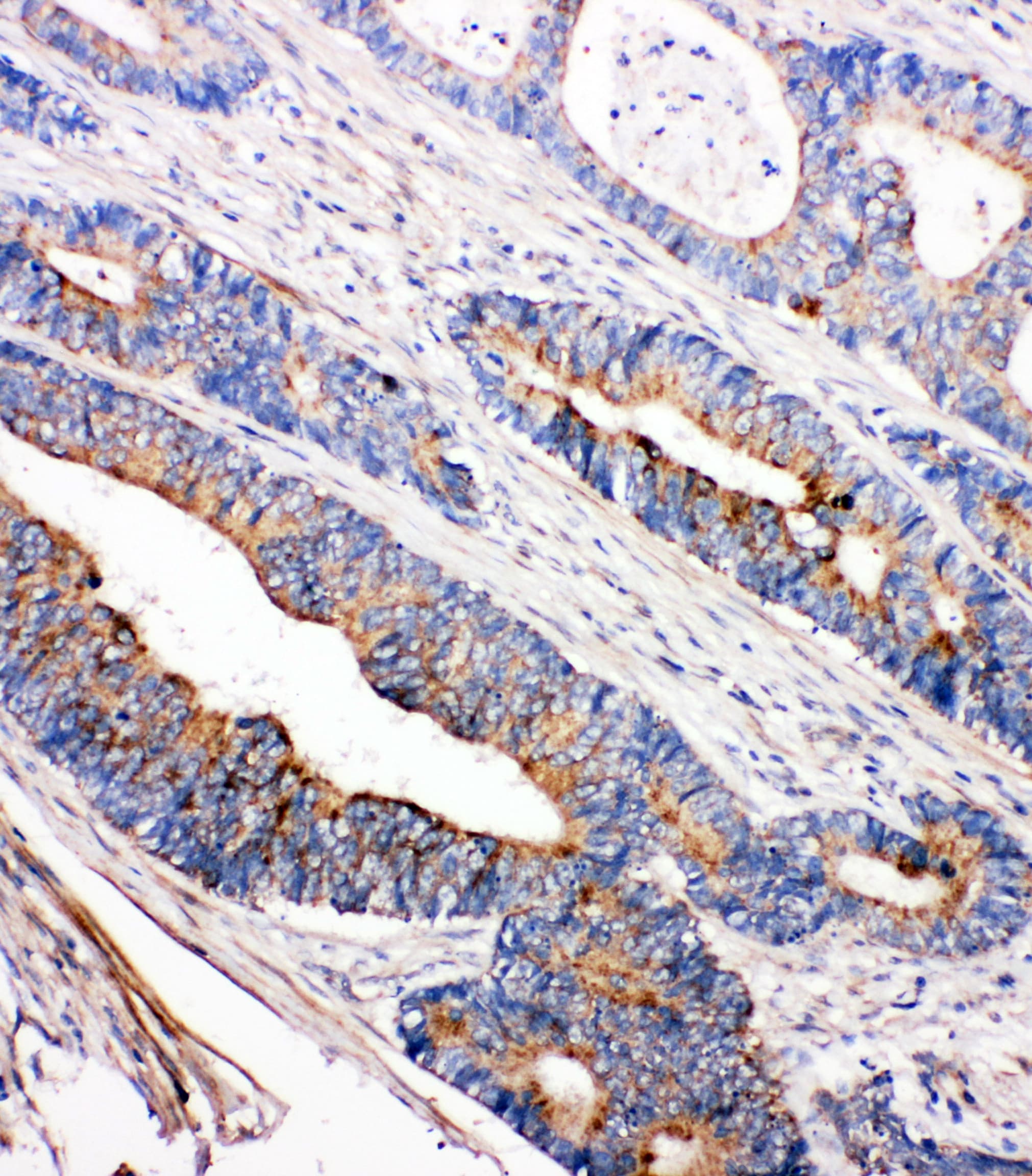 TEC Antibody (aa612-631)