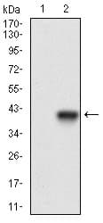PathPlus™ MCAM / CD146 Antibody (aa84-189, clone 6C3E6)