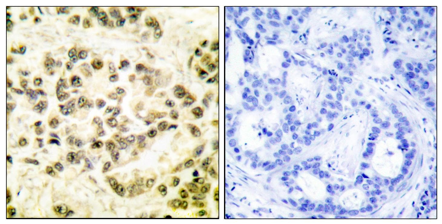 STAT5B Antibody (phospho-Ser731)