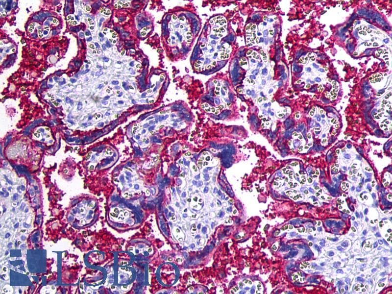 IHC-plus™ CD46 Antibody (clone MEM-258)