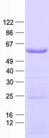 Human PALS2 / MPP6 Protein (Recombinant His, N-Terminal)