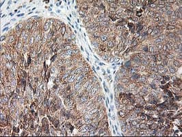 RPN1 / Ribophorin I Antibody (clone OTI3H3)
