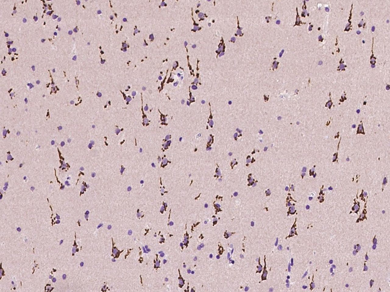 B4GALNT1 / GM2/GD2 Synthase Antibody