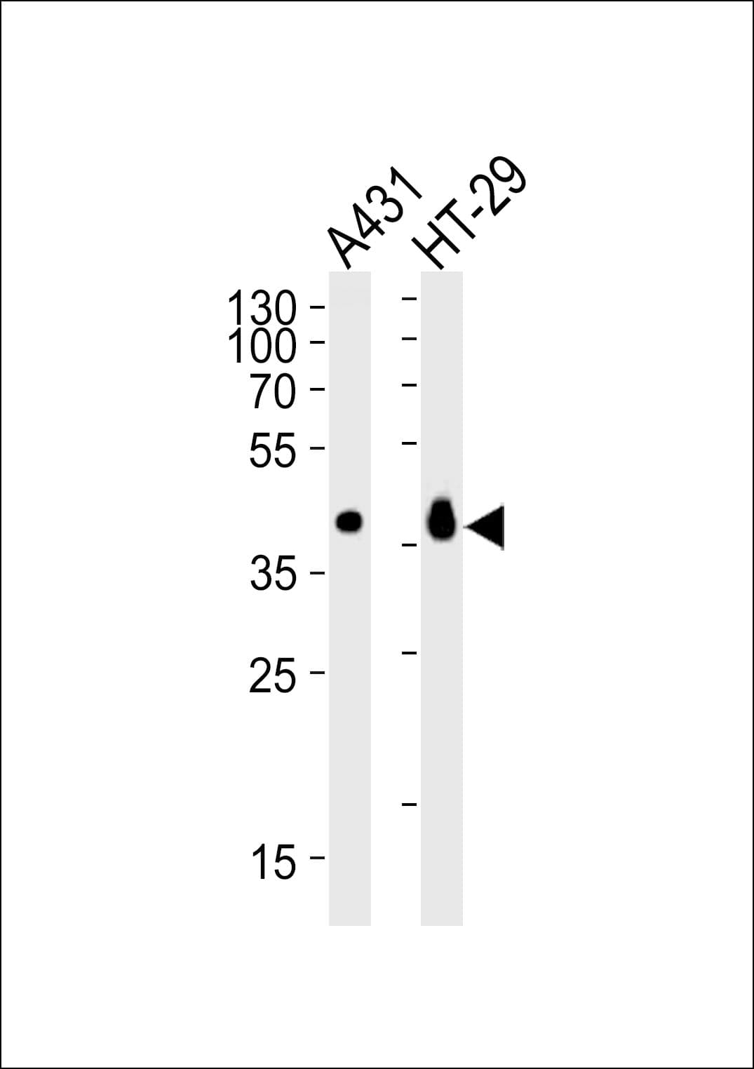 EPCAM Antibody (aa299-334)