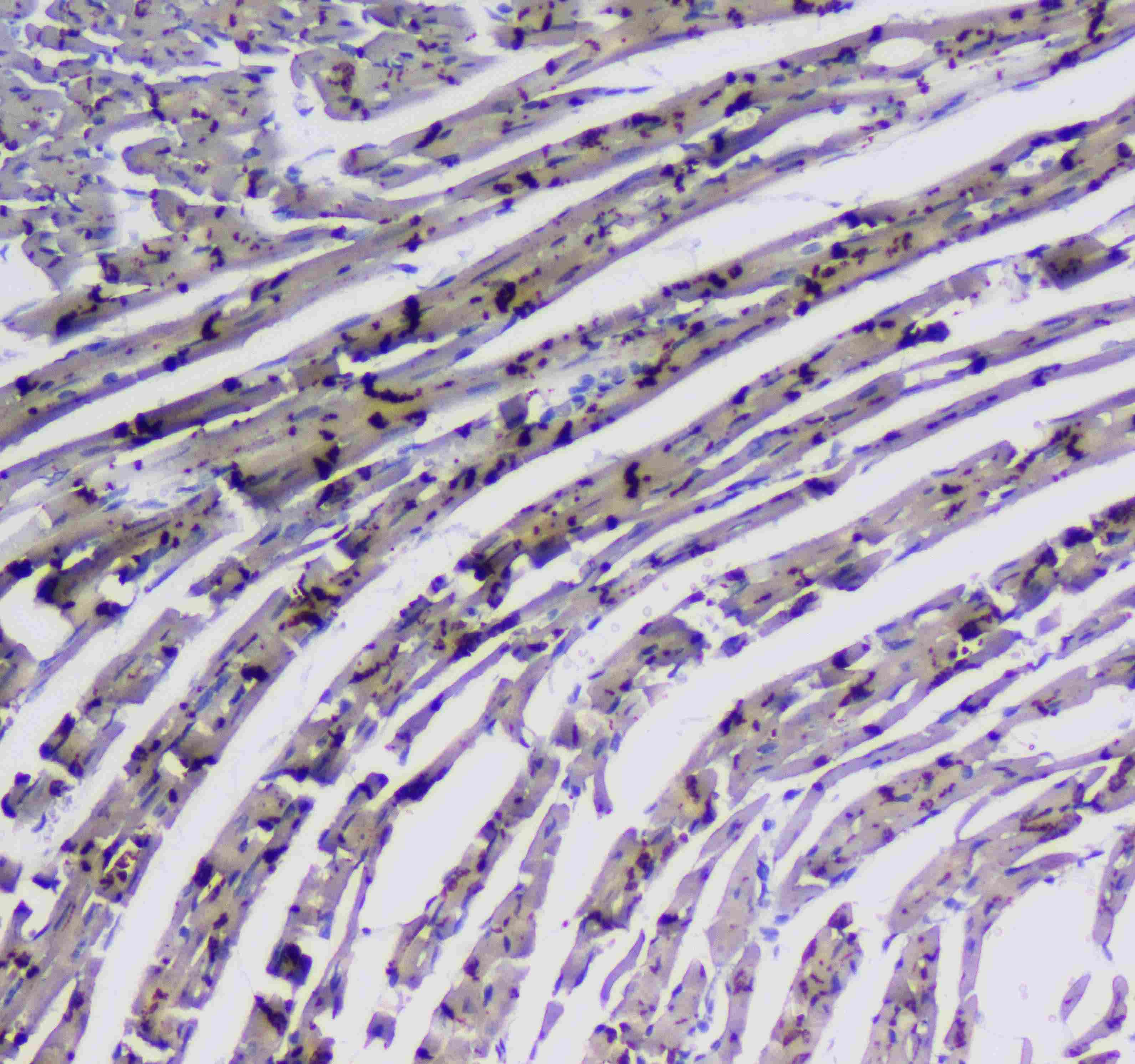 Polyclonal Rabbit anti-Human ITGA5/Integrin Alpha 5/CD49e Antibody (IHC, WB)