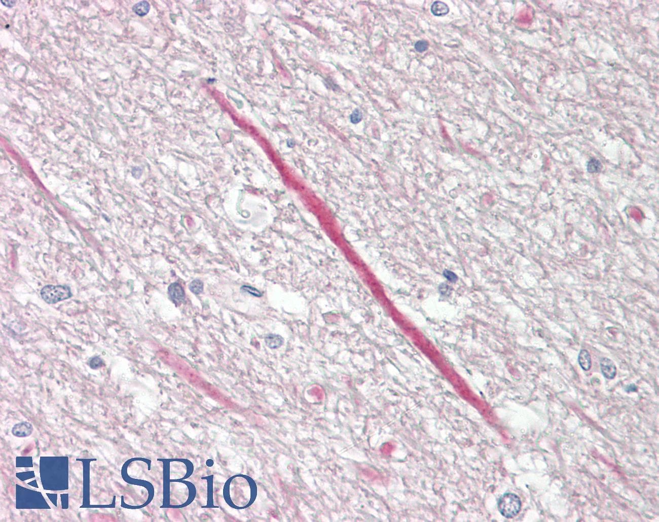 IHC-plus™ KCNT1 / KCa4.1 Antibody (aa1019-1068)