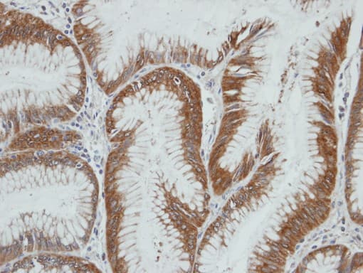 AKR1C4 / Chlordecone Reductase Antibody (aa1-217)