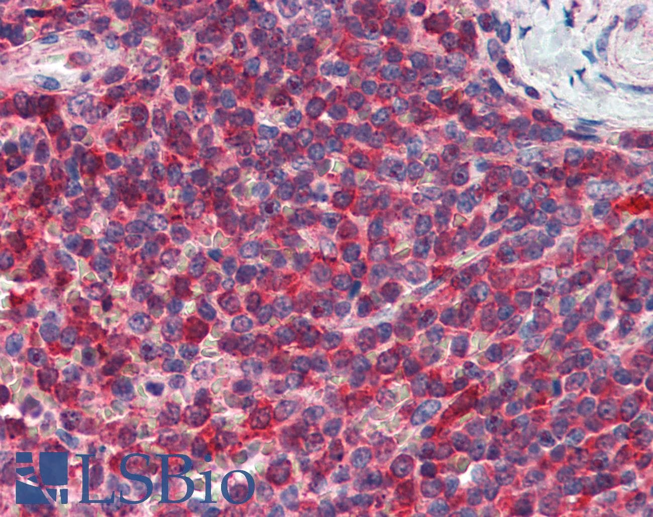 IHC-plus™ PIP4K2A / PIPK Antibody (clone 3A3)