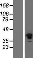 FGFR1 / FGF Receptor 1 Protein (Over-Expression Lysate Myc-DDK (Flag))