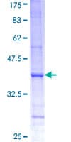 Human PSMD6 Protein (Recombinant GST, N-terminus)