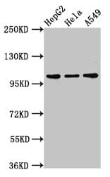 Polyclonal Rabbit anti-Human CHD1L Antibody (IF, WB)