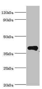 RD / PHYH Antibody (aa1-338)