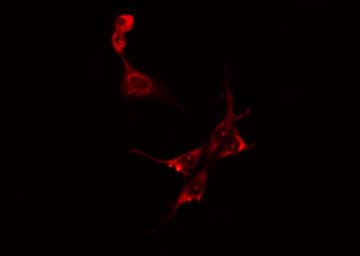 CKM / Creatine Kinase MM Antibody