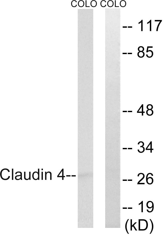 CLDN4 / Claudin 4 Antibody (aa160-209)