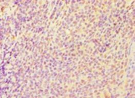 CASP6 / Caspase 6 Antibody (aa24-293)