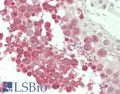 IHC-plus™ OPRM1 / Mu Opioid Receptor Antibody (aa8-57)