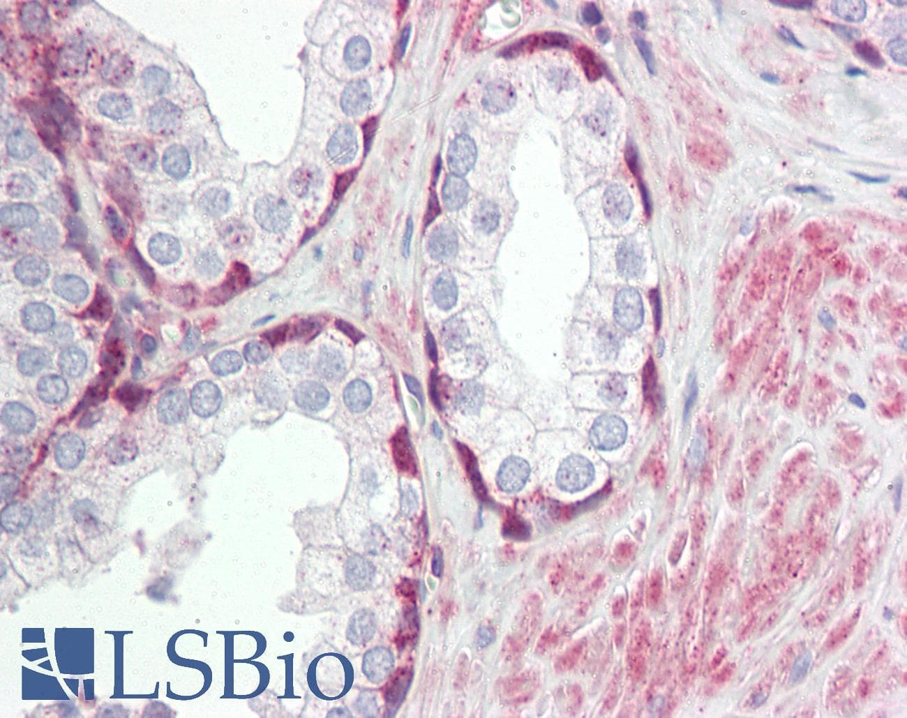 IHC-plus™ Polyclonal Rabbit anti-Human TRIM59 Antibody (aa191-240, IHC, IF, WB)