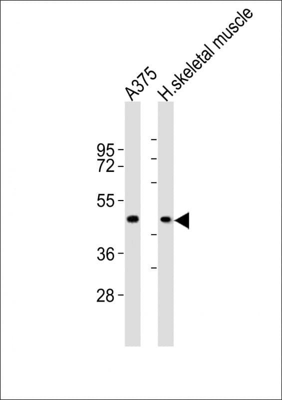 CCR1 Antibody (aa13-44)