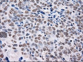 Monoclonal Mouse anti-Human PSMD10 / Gankyrin Antibody (clone OTI3F6, WB)