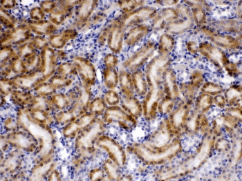 TIMP4 Antibody