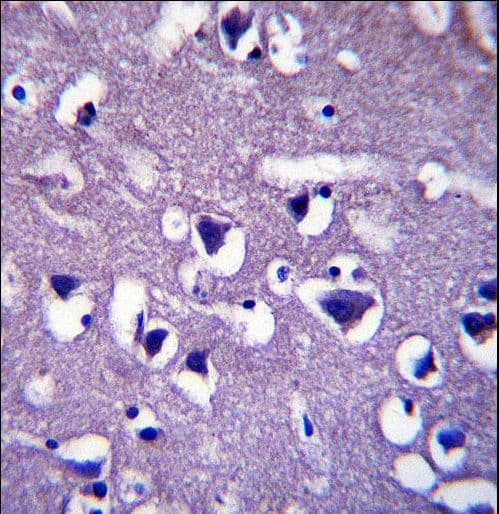 CCDC117 Antibody (aa143-171)