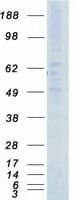 Human ACVRL1 Protein (Recombinant Myc-DDK (Flag))