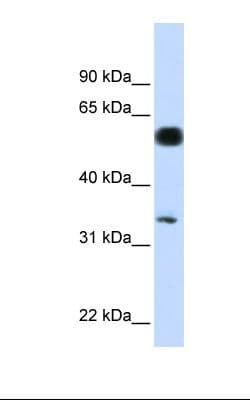 Polyclonal Rabbit anti-Human BABAM1 / HSPC142 Antibody (aa36-85, IHC, WB)