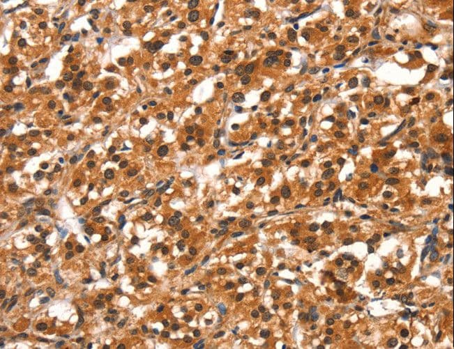 Polyclonal Rabbit anti-Human DDX4 / VASA Antibody (IHC)