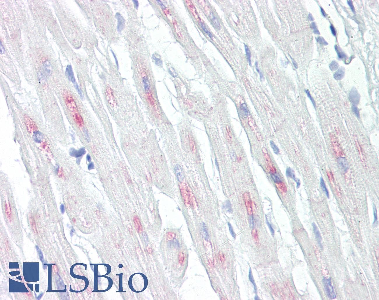 IHC-plus™ CRYAB / Alpha B Crystallin Antibody (aa31-80)