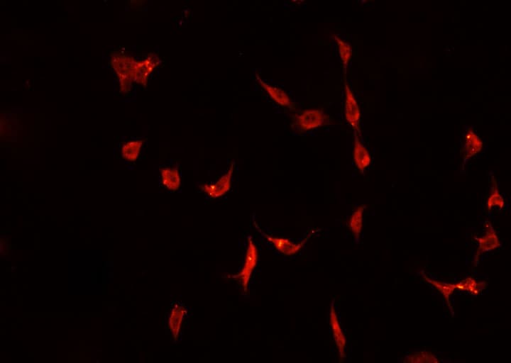 DNAJB1 / Hsp40 Antibody