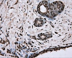 ERCC1 Antibody (clone OTI2H5)