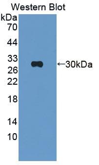 MBL2 / Mannose Binding Protein Antibody (aa19-244)