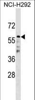 CDC20B Antibody (aa11-39)